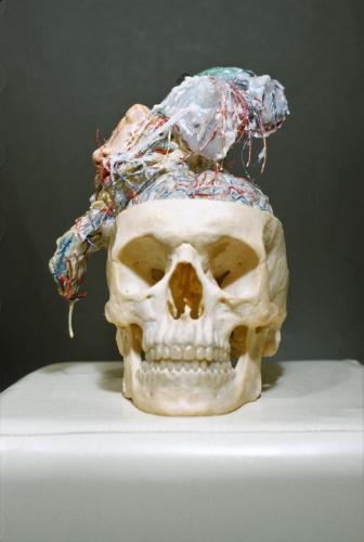 4 |" Psychogenes, anatomisches Modell,(Tumor)",1984